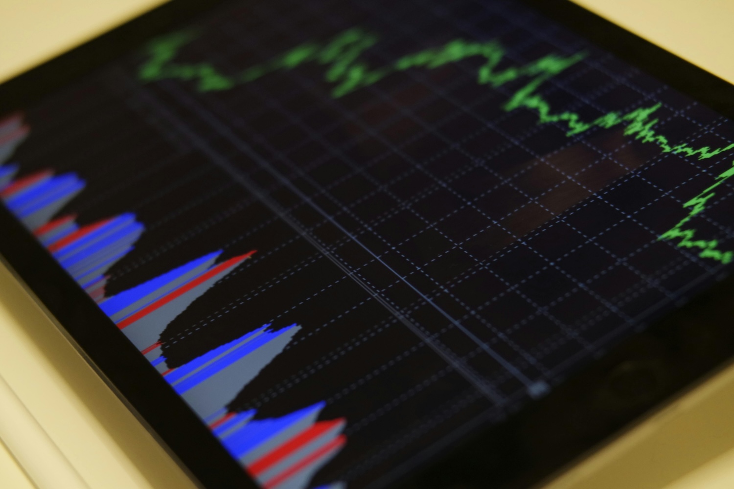 Technical Analysis vs. Fundamental Analysis in Stock Screening